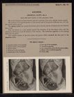 Abdomen. Abdominal Cavity - no. 6
